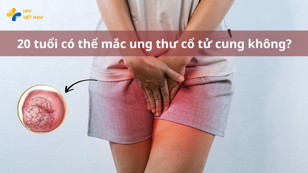 20 tuổi có thể mắc ung thư cổ tử cung không?
