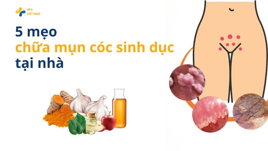 5 mẹo chữa mụn cóc sinh dục tại nhà
