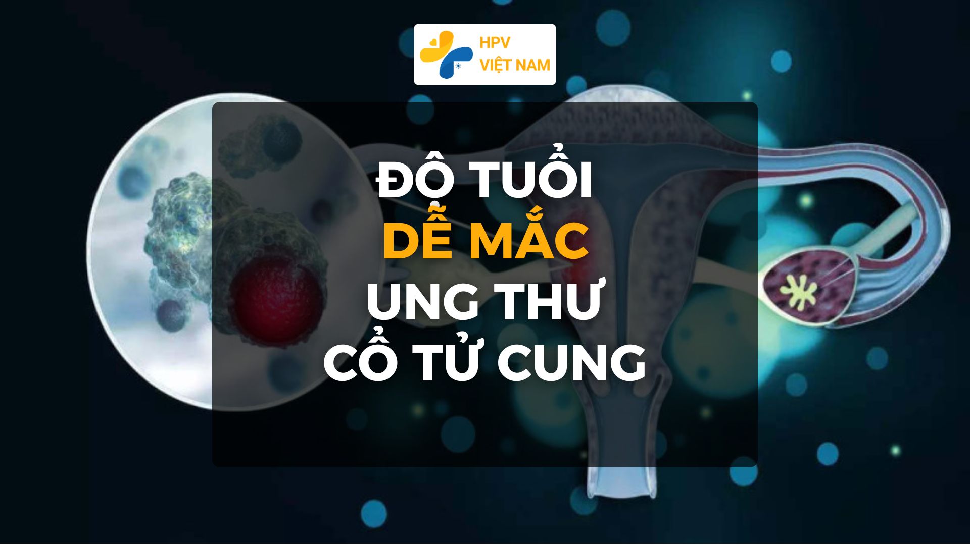 Độ tuổi dễ mắc ung thư cổ tử cung