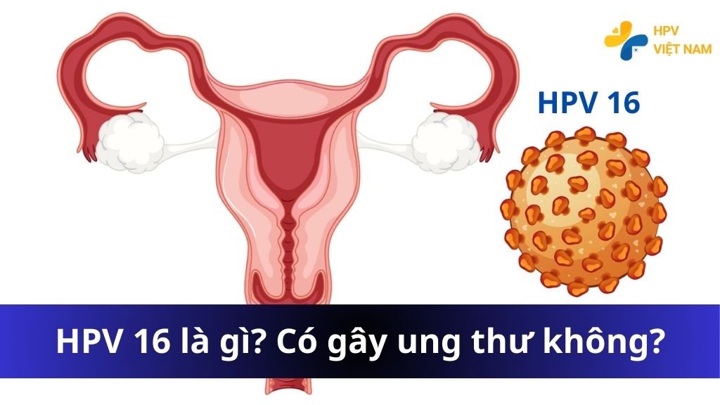 HPV 16 là gì? Có gây ung thư cổ tử cung không?