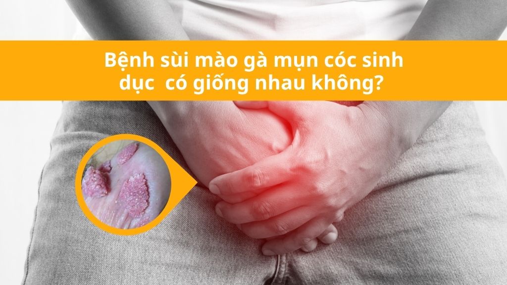  bệnh sùi mào gà mụn cóc sinh dục có giống nhau không?