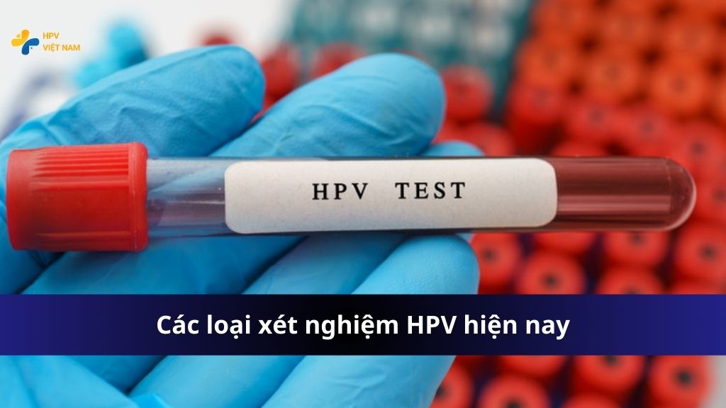 Các loại xét nghiệm HPV phổ biến hiện nay trên thị trường