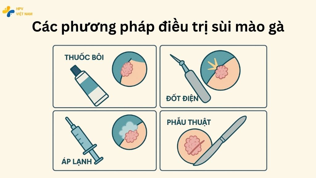 Các phương pháp điều trị sùi mào gà