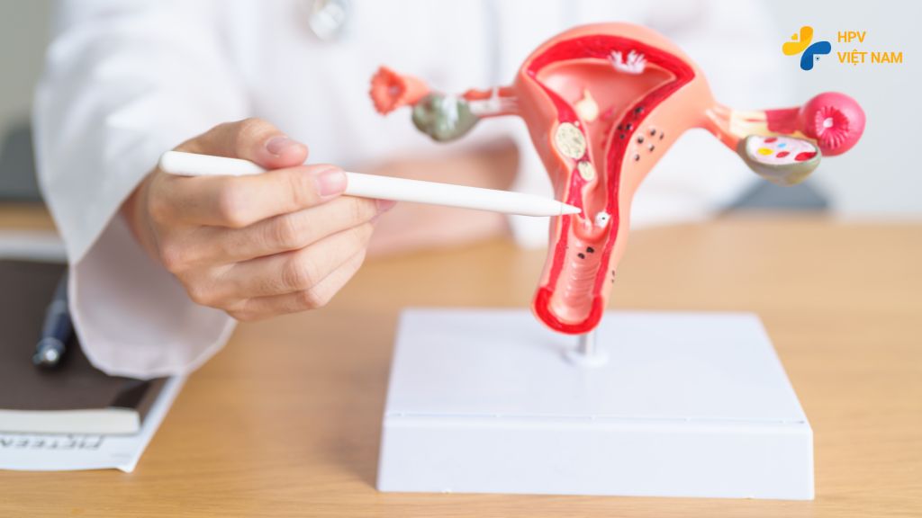 Cách điều trị nếu mắc HPV nguyên nhân gây UTCTC