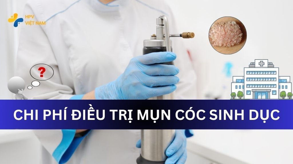 Chi phí điều trị mụn cóc sinh dục