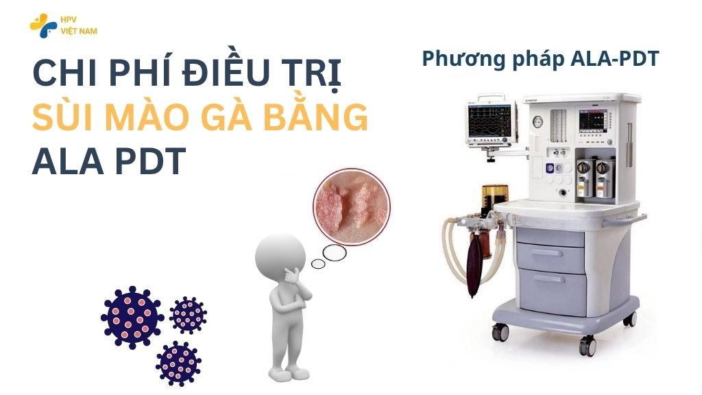 Chi phí điều trị sùi mào gà bằng ala pdt