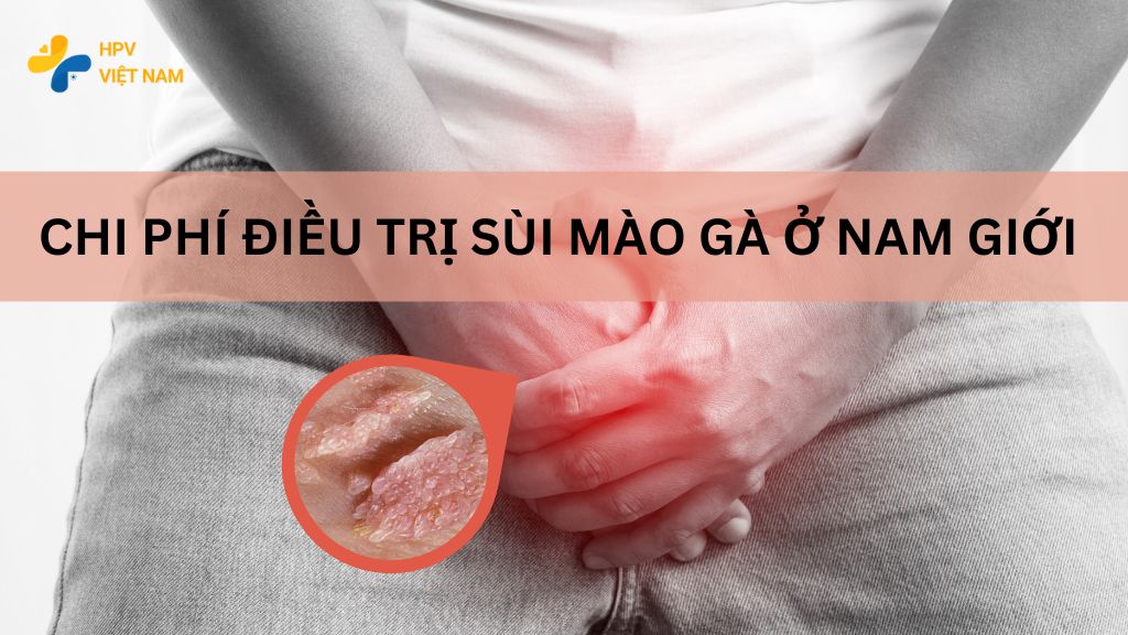 Chi phí điều trị sùi mào gà ở nam giới 