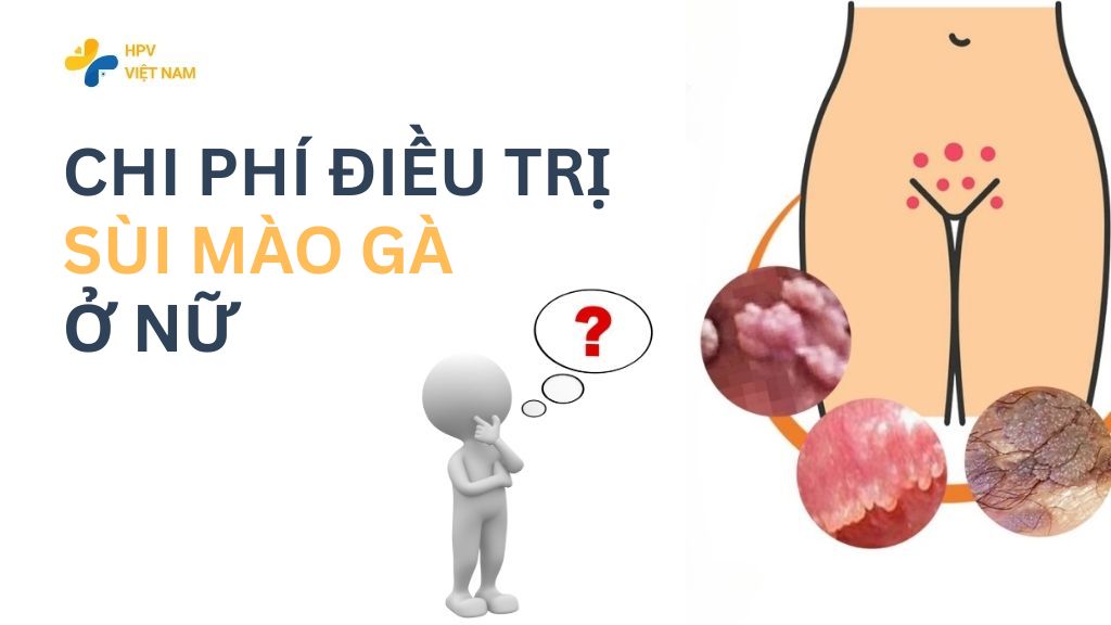 Chi phí điều trị sùi mào gà ở nữ