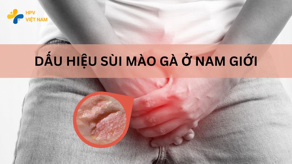 Dấu hiệu sùi mào gà ở nam giới