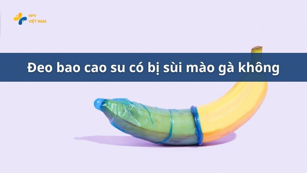 Đeo bao cao su có bị sùi mào gà không