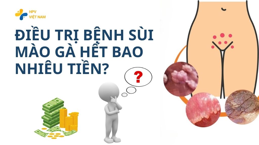Điều trị bệnh sùi mào gà hết bao nhiêu tiền
