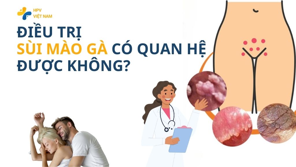 Điều trị sùi mào gà có quan hệ được không