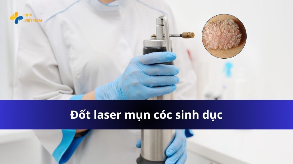 Đốt laser mụn cóc sinh dục