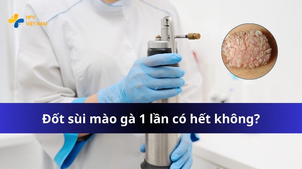 Đốt sùi mào gà 1 lần có hết không