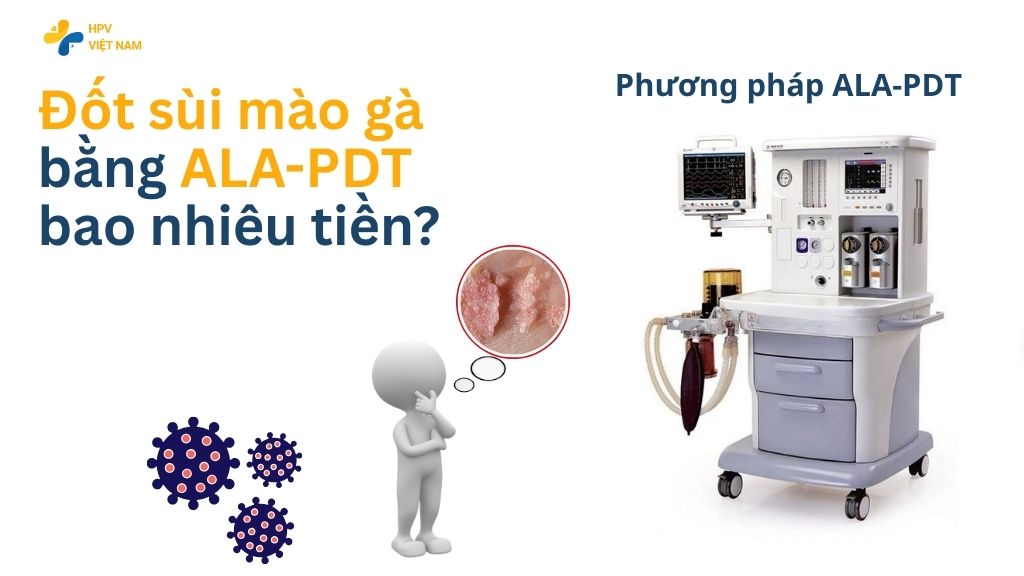 Đốt sùi mào gà bằng ala pdt bao nhiêu tiền