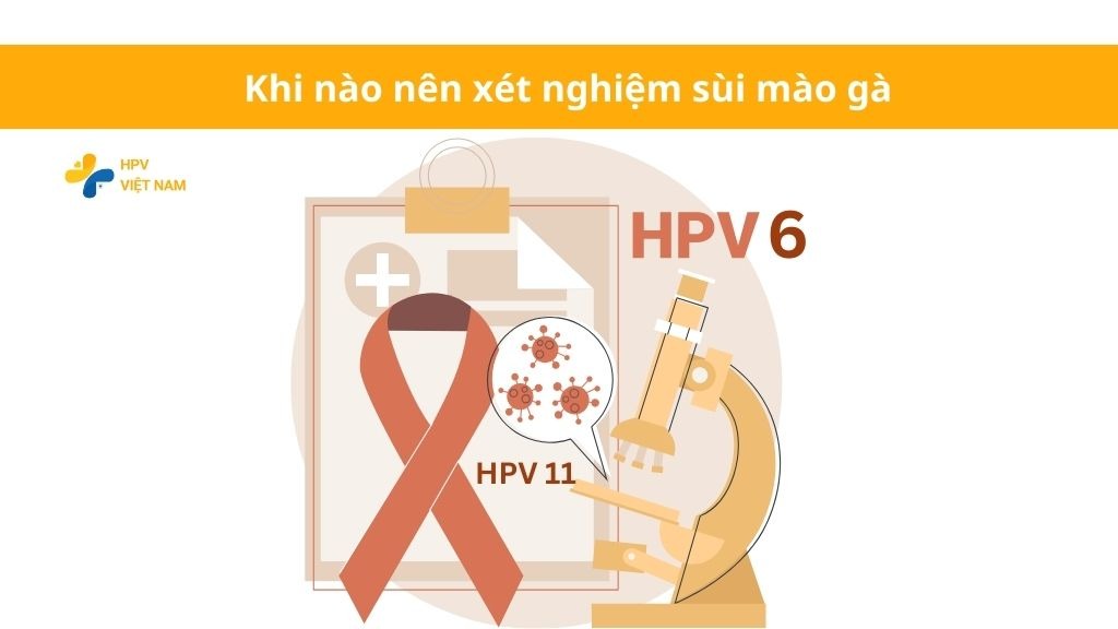 Khi nào nên xét nghiệm sùi mào gà