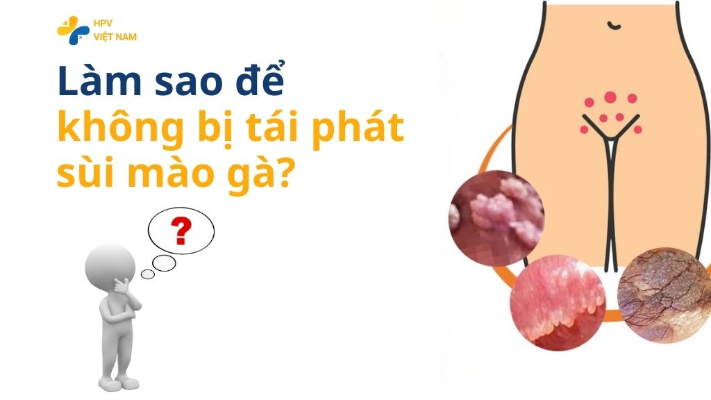 Làm sao để không bị tái phát sùi mào gà