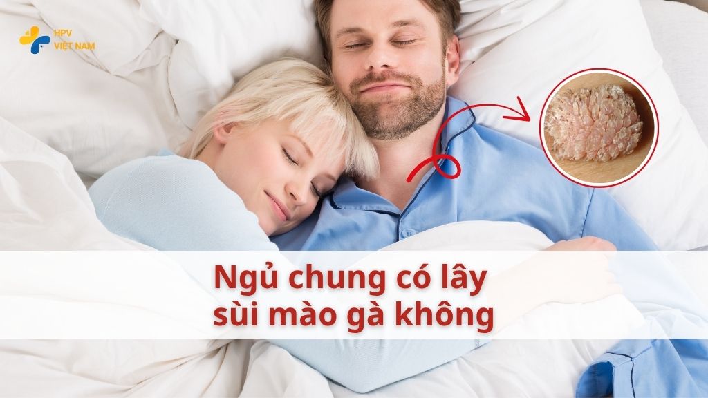 Ngủ chung có lây sùi mào gà không