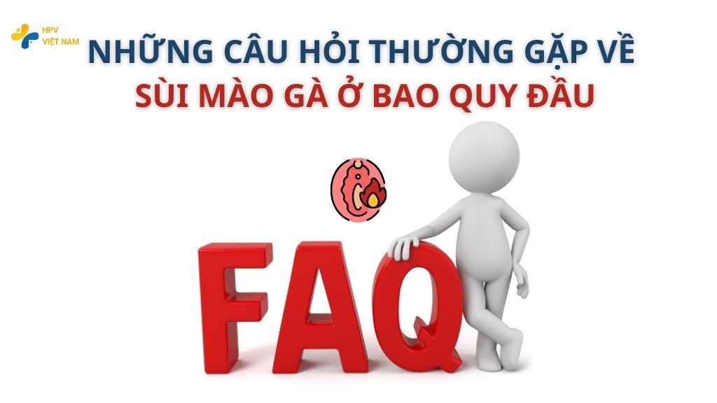 Những câu hỏi thường gặp về sùi mào gà ở bao quy đầu