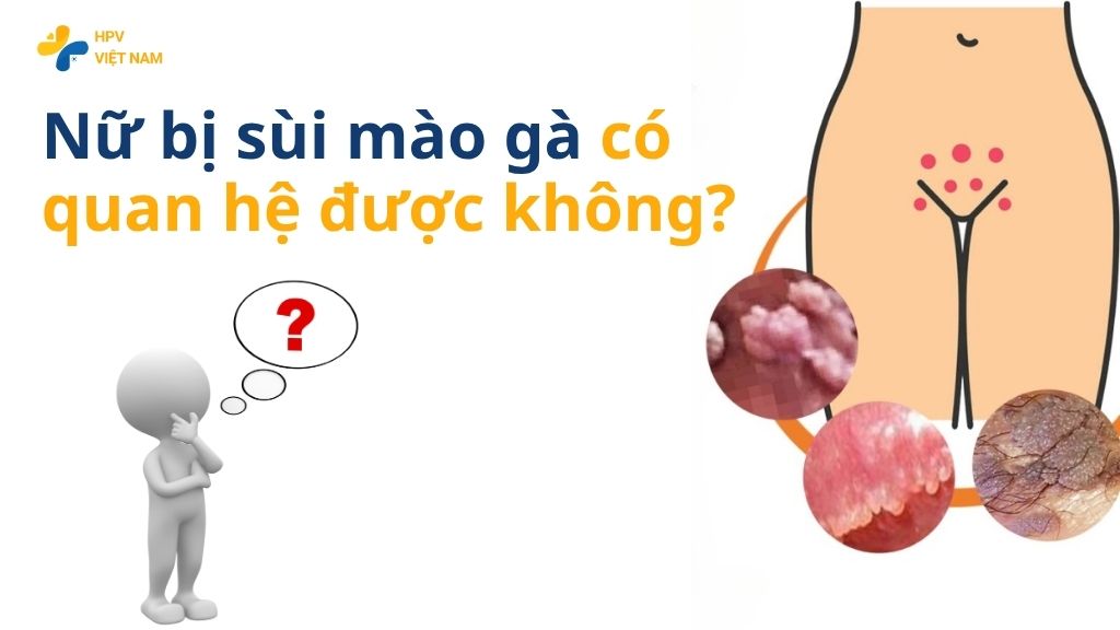 Nữ bị sùi mào gà có quan hệ được không