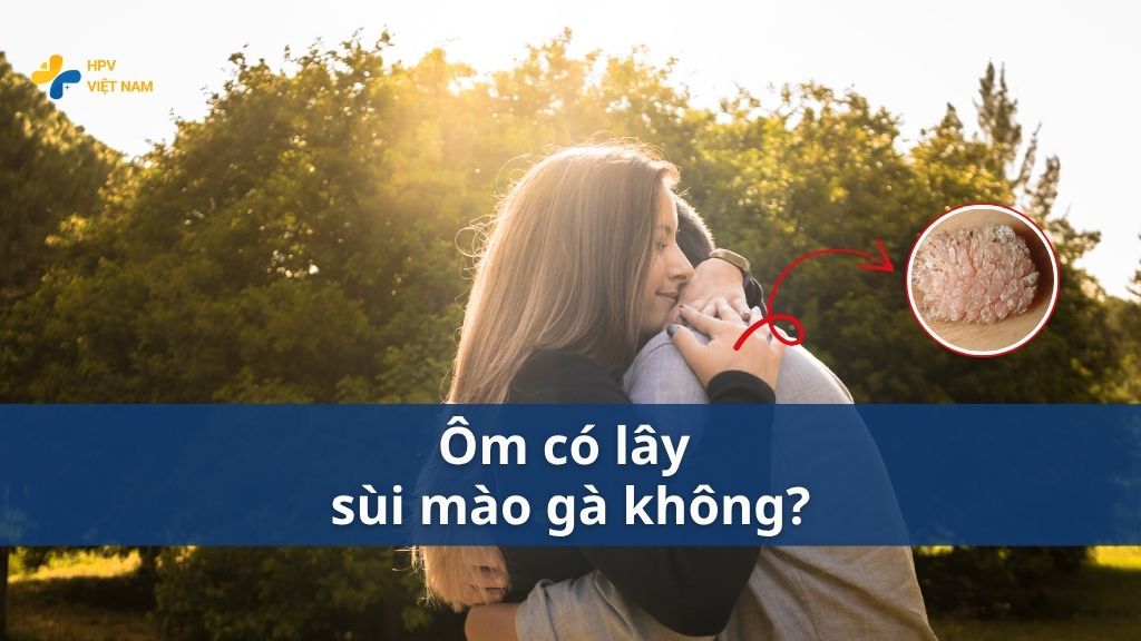 Ôm có lây sùi mào gà không