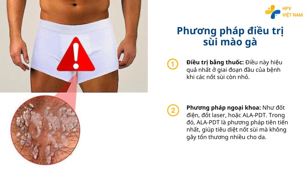 Phương pháp điều trị sùi mào gà
