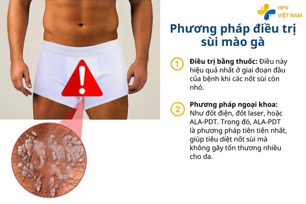 Các phương pháp điều trị sùi mào gà