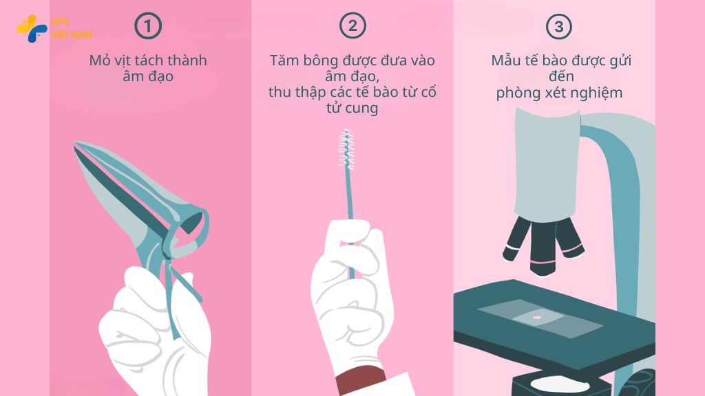 Quy trình xét nghiệm Pap Smear