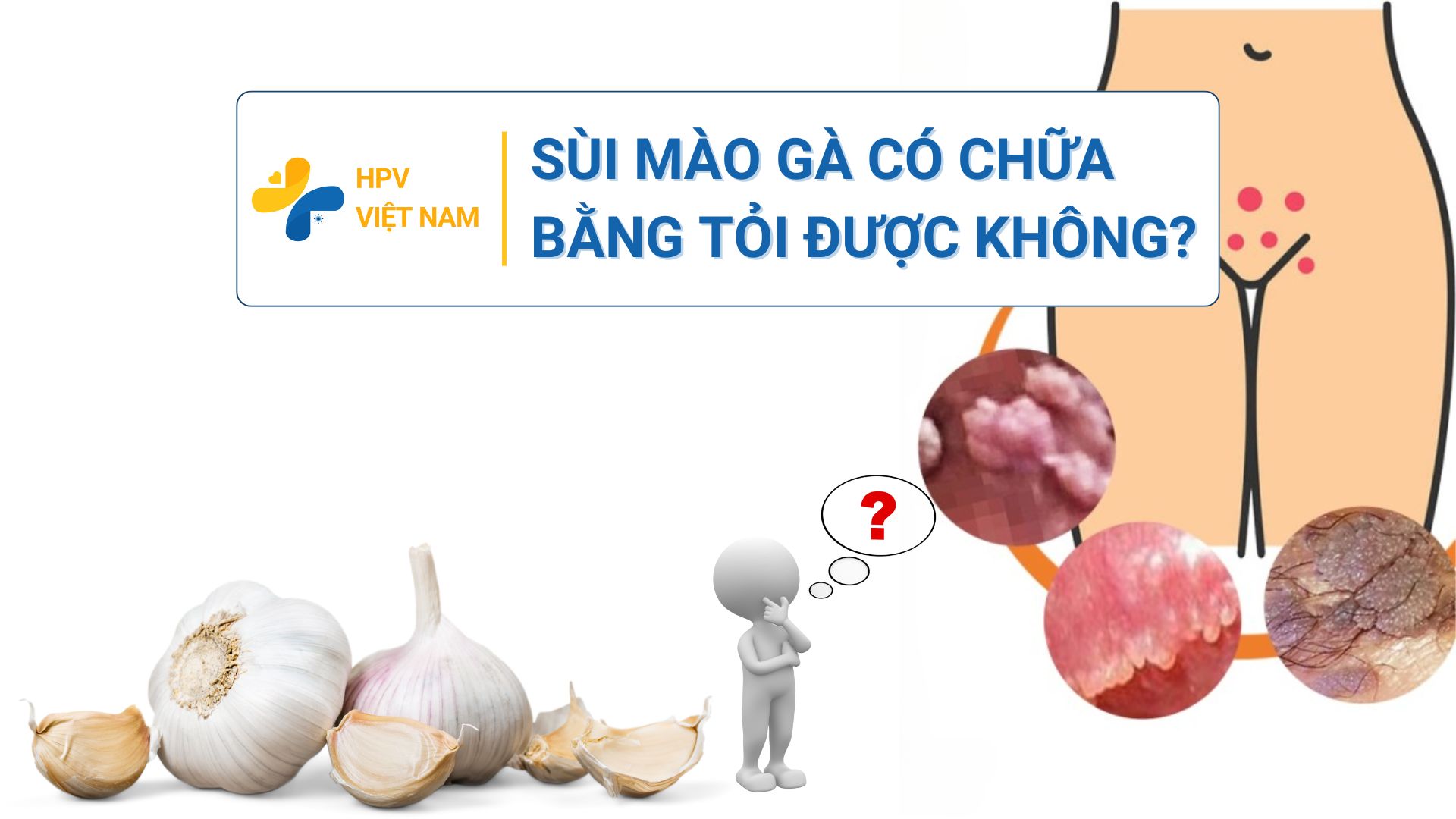 Sùi mào gà có điều trị bằng tỏi được không