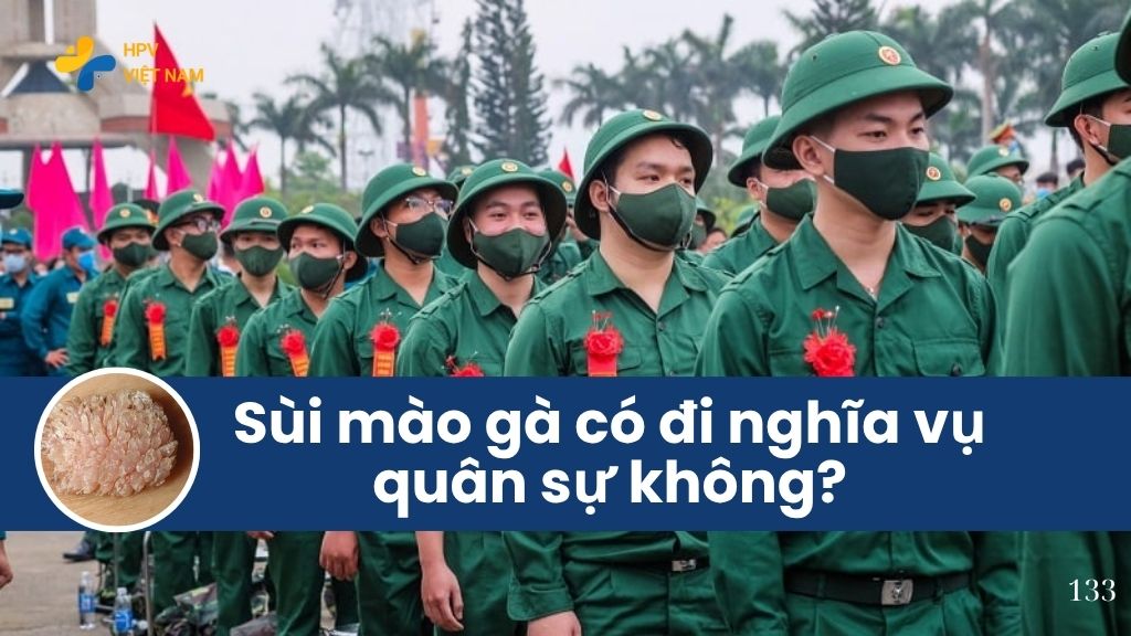 Sùi mào gà có đi nghĩa vụ quân sự không