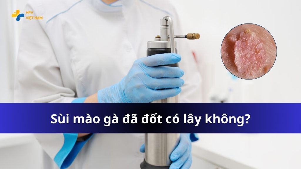 Sùi mào gà đã đốt có lây không