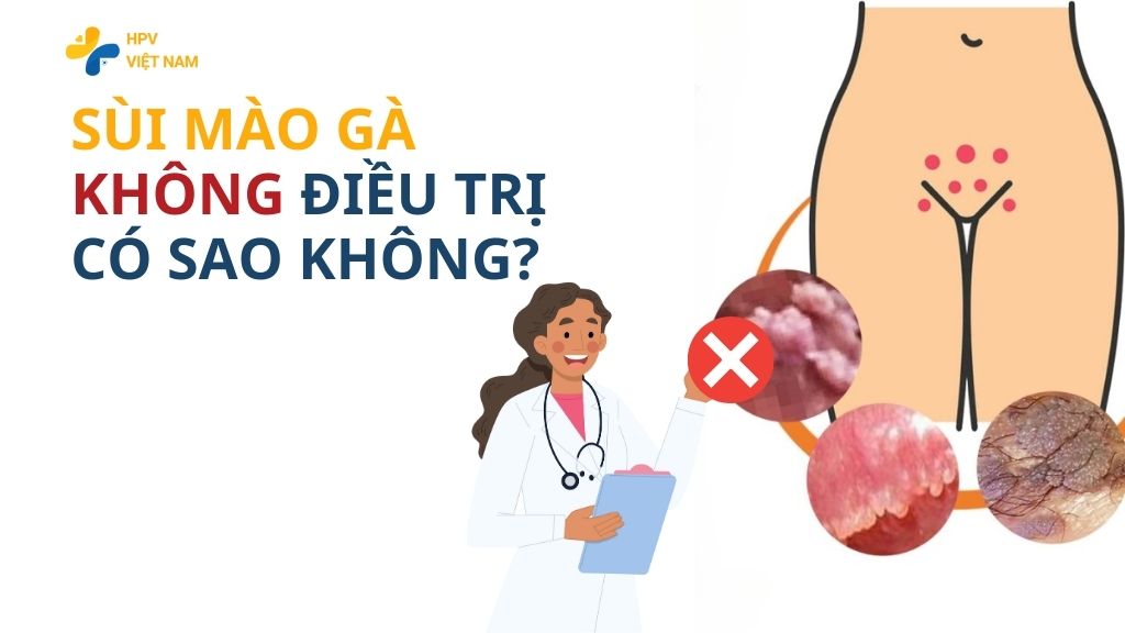 Sùi mào gà không điều trị có sao không