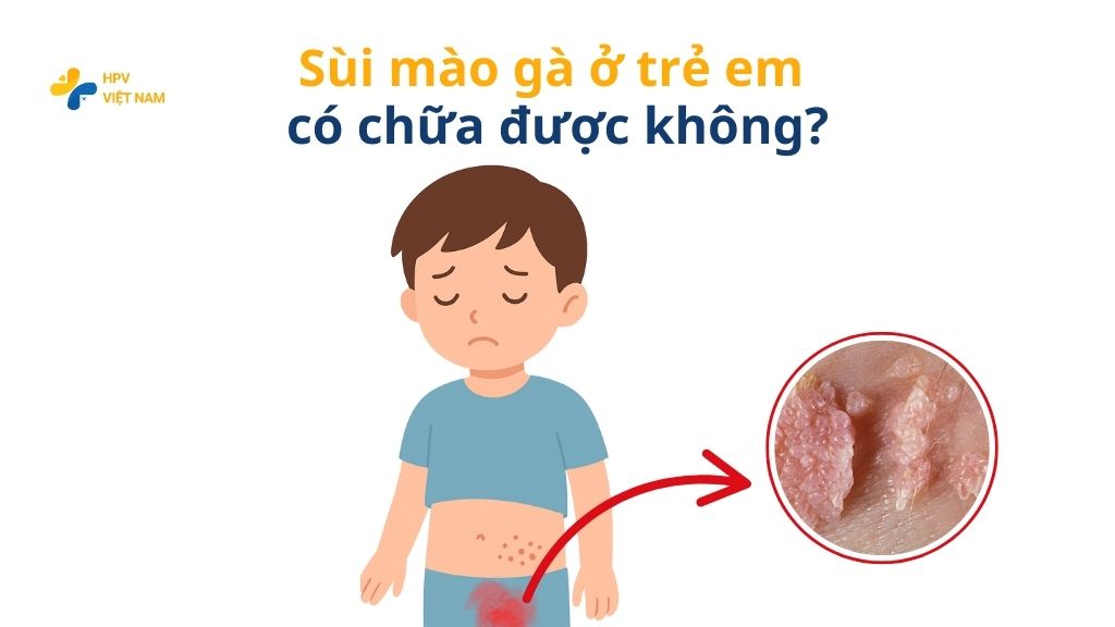 sùi mào gà ở trẻ em có chữa được không