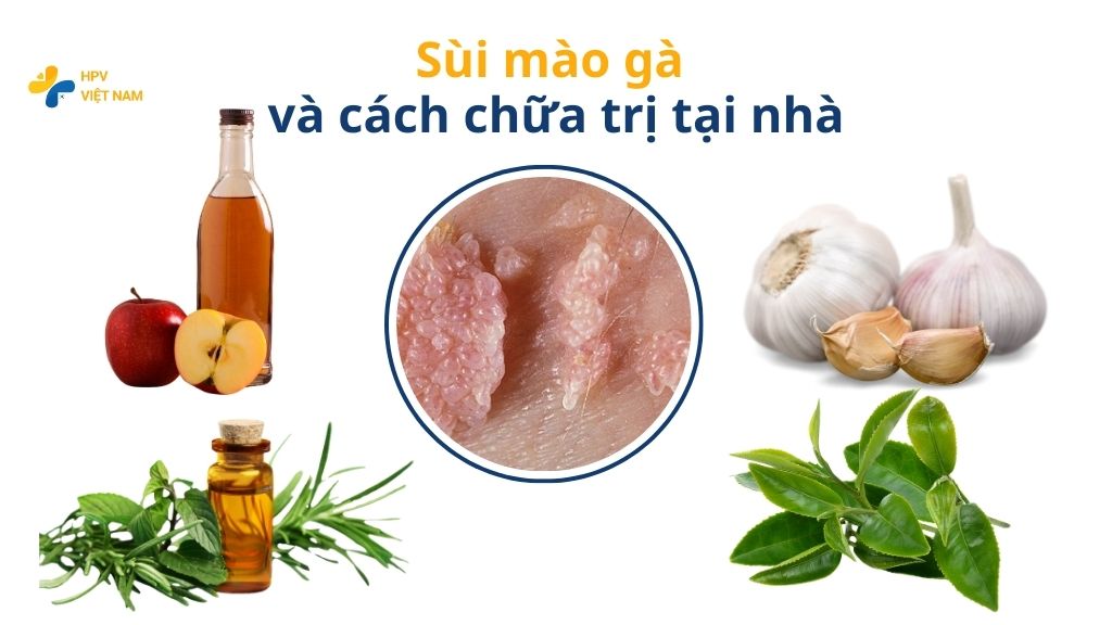 Sùi mào gà và cách chữa trị tại nhà