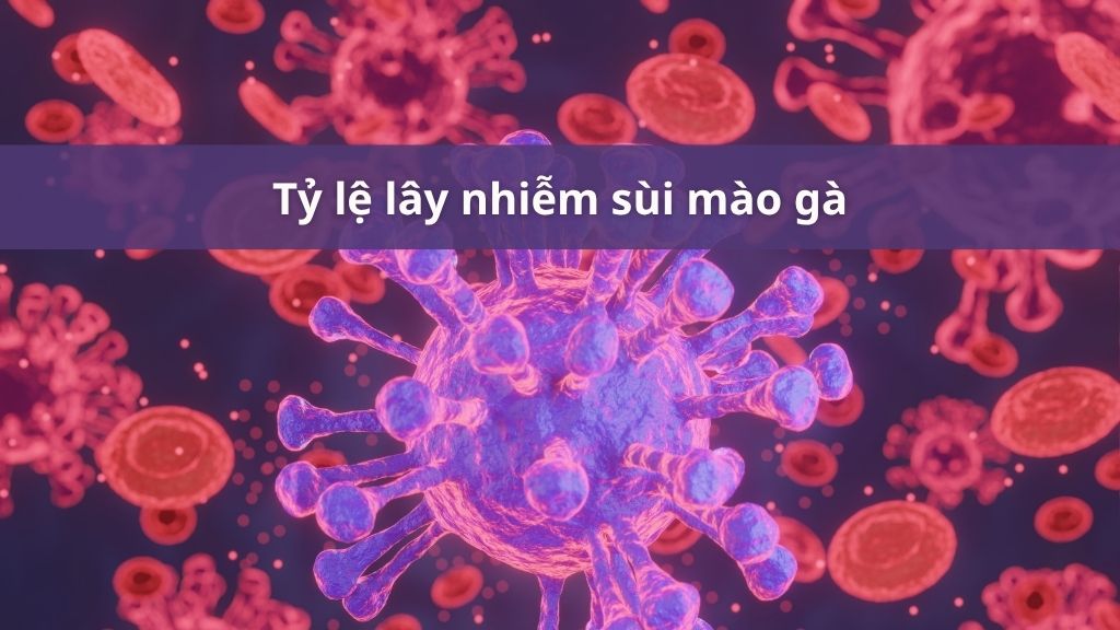 Tỷ lệ lây nhiễm sùi mào gà
