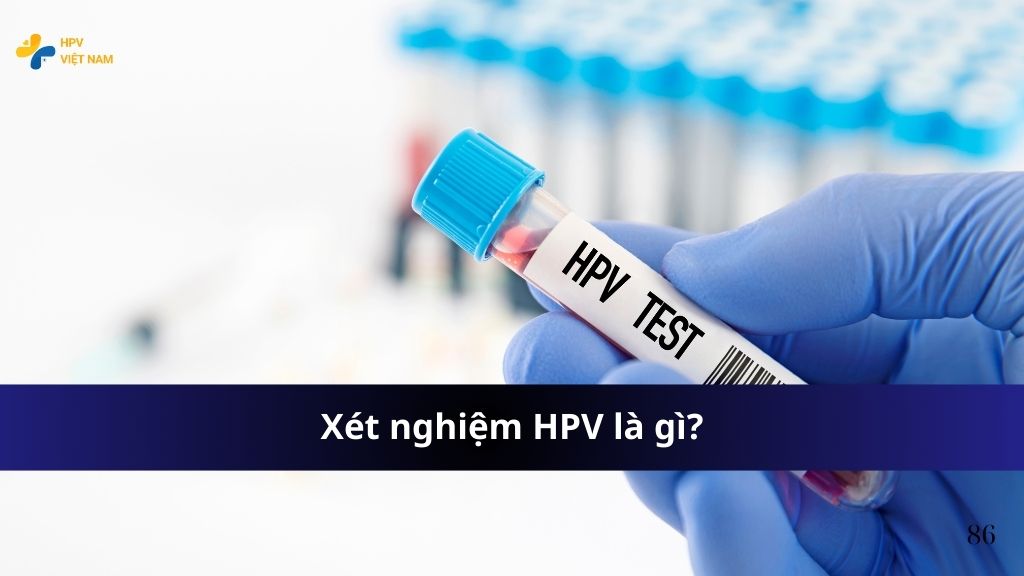 Xét nghiệm HPV là gì?