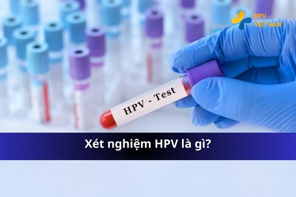 Xét nghiệm HPV là gì