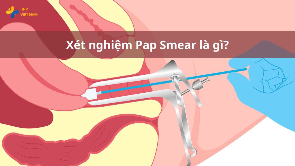 Xét nghiệm Pap Smear là gì?