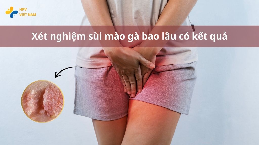 xét nghiệm sùi mào gà bao lâu có kết quả