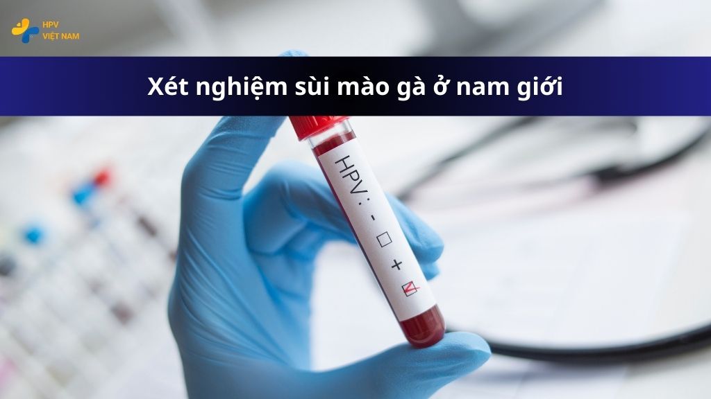 Xét nghiệm sùi mào gà ở nam giới